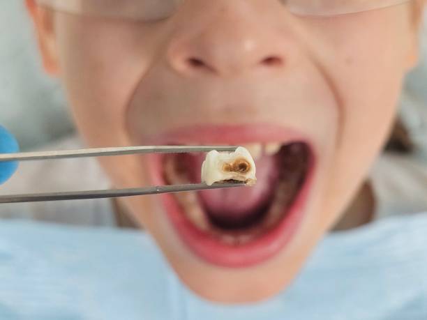 Best Holiday Emergency Dentist in Crowley, TX